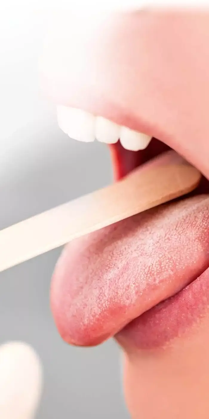 Methoden_Zungendiagnostik